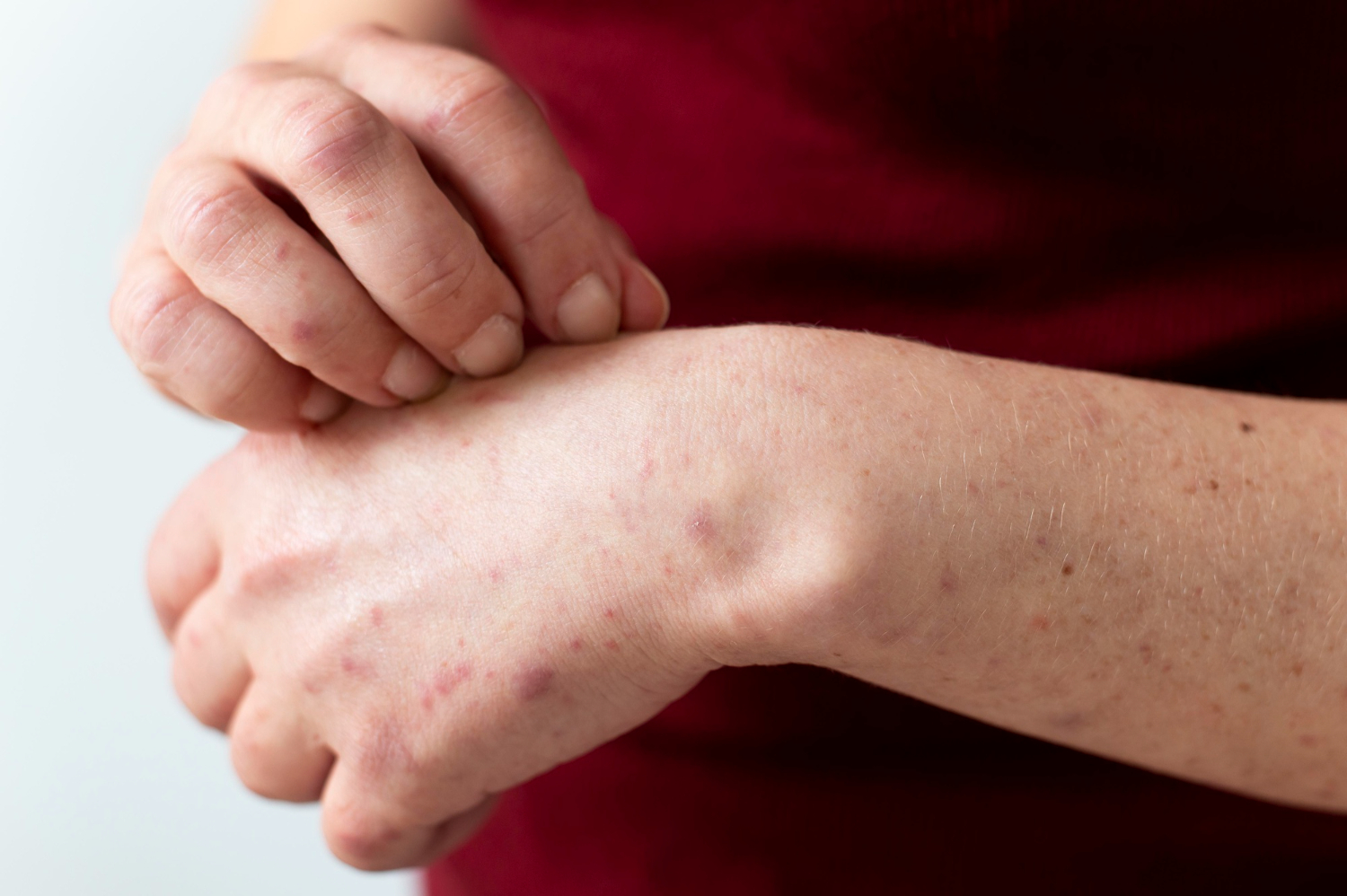 Hereditary Angioedema Support