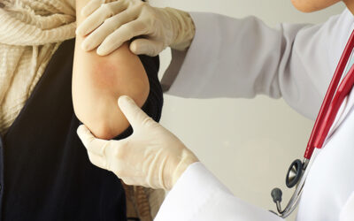 Is chronic eczema caused by food allergies?