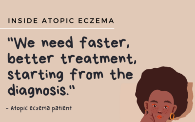 World Atopic Eczema Day