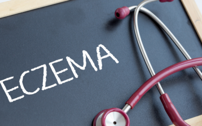 Can Eczema be Cured?